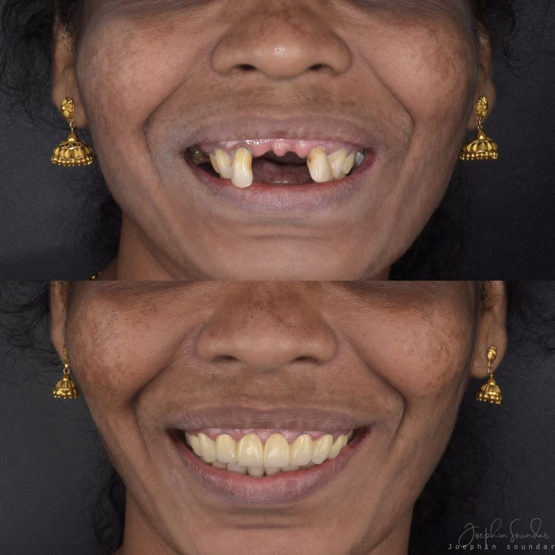Dental Case 2
