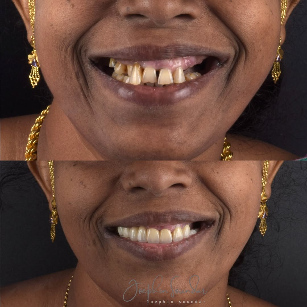 Dental Case 10