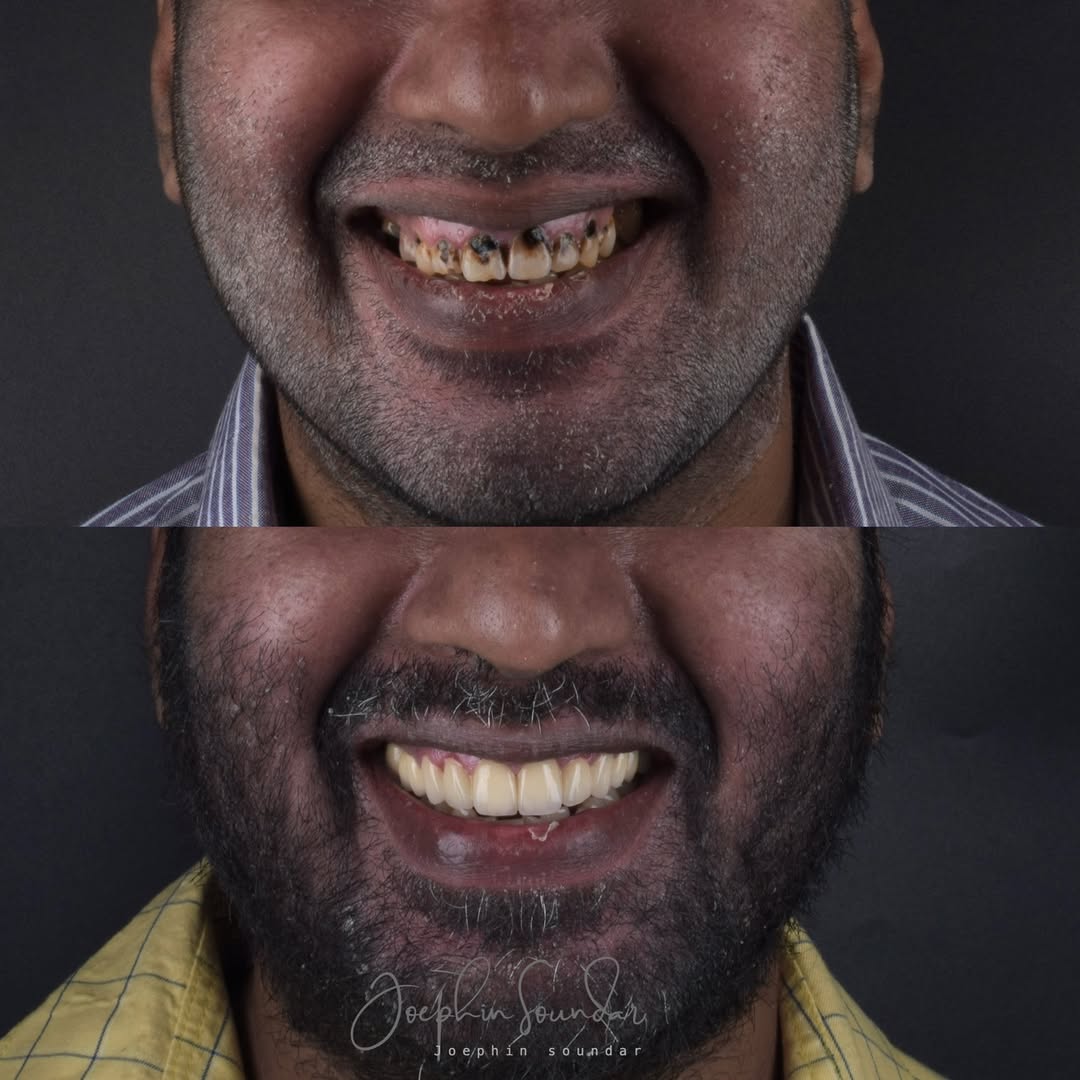 Dental Case 11