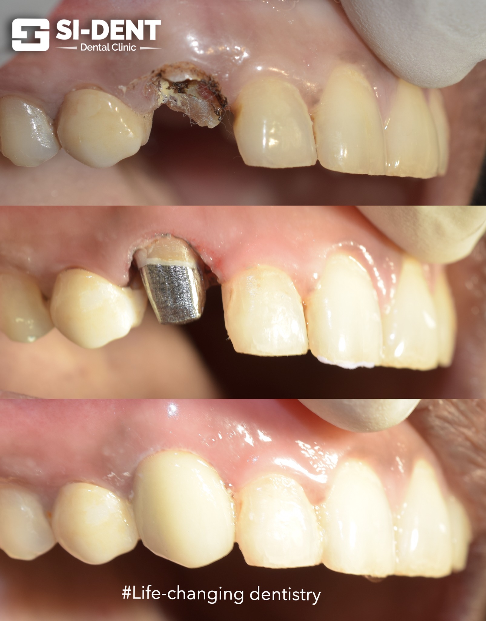 Dental Case 14