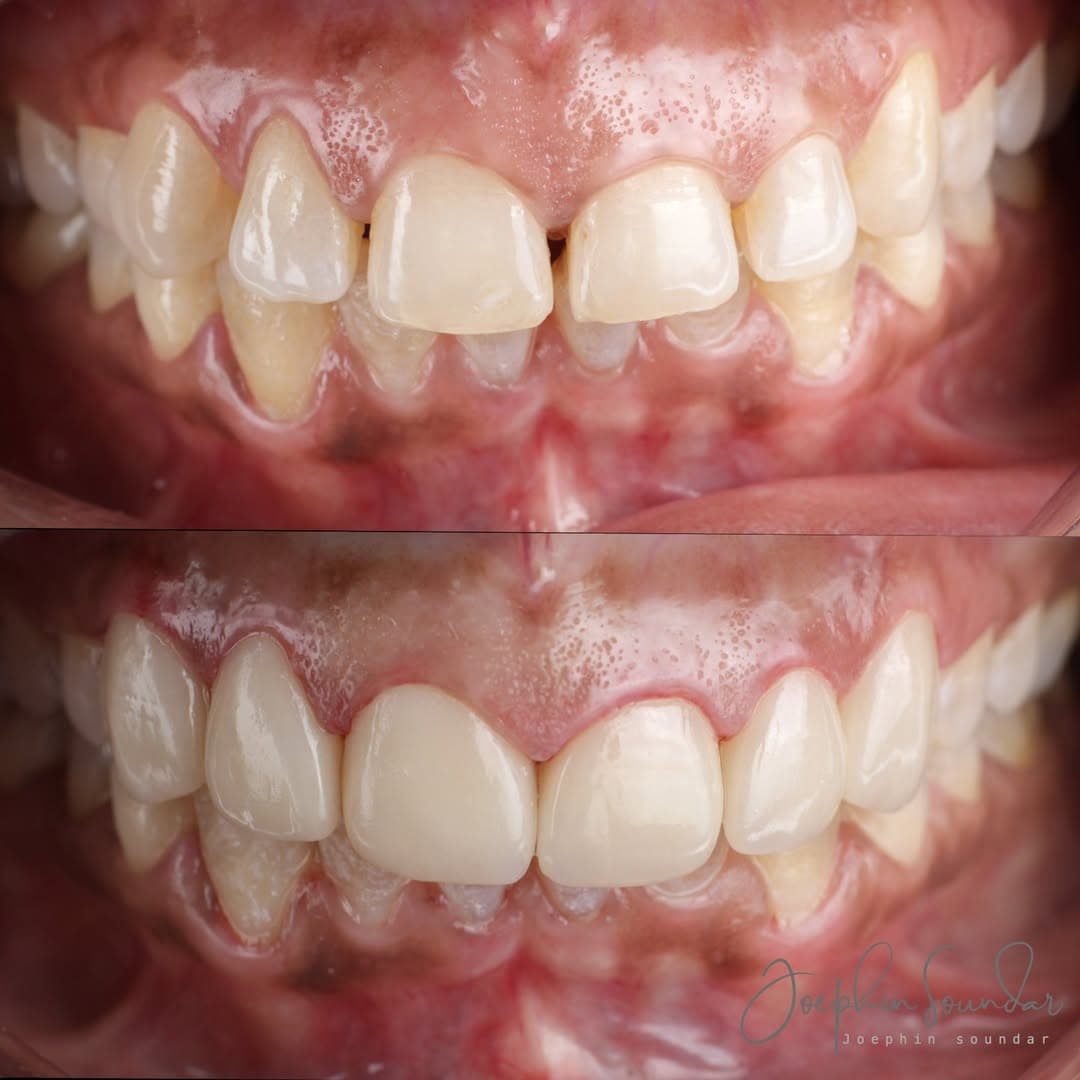 Dental Case 1