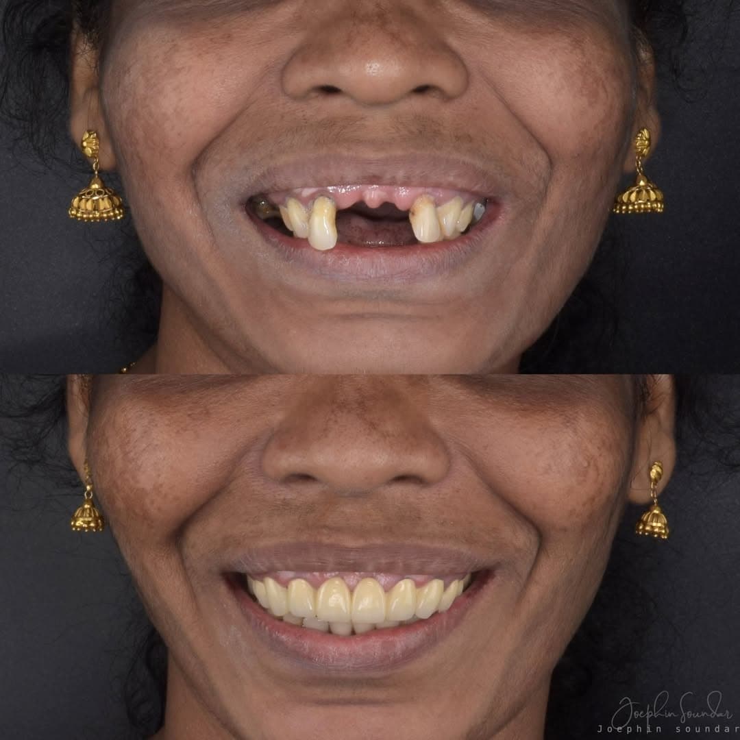 Dental Case 2