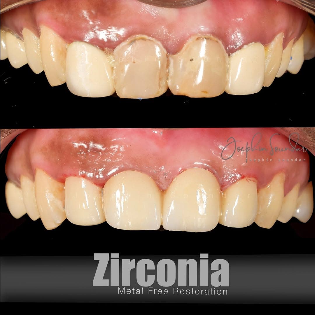 Dental Case 3