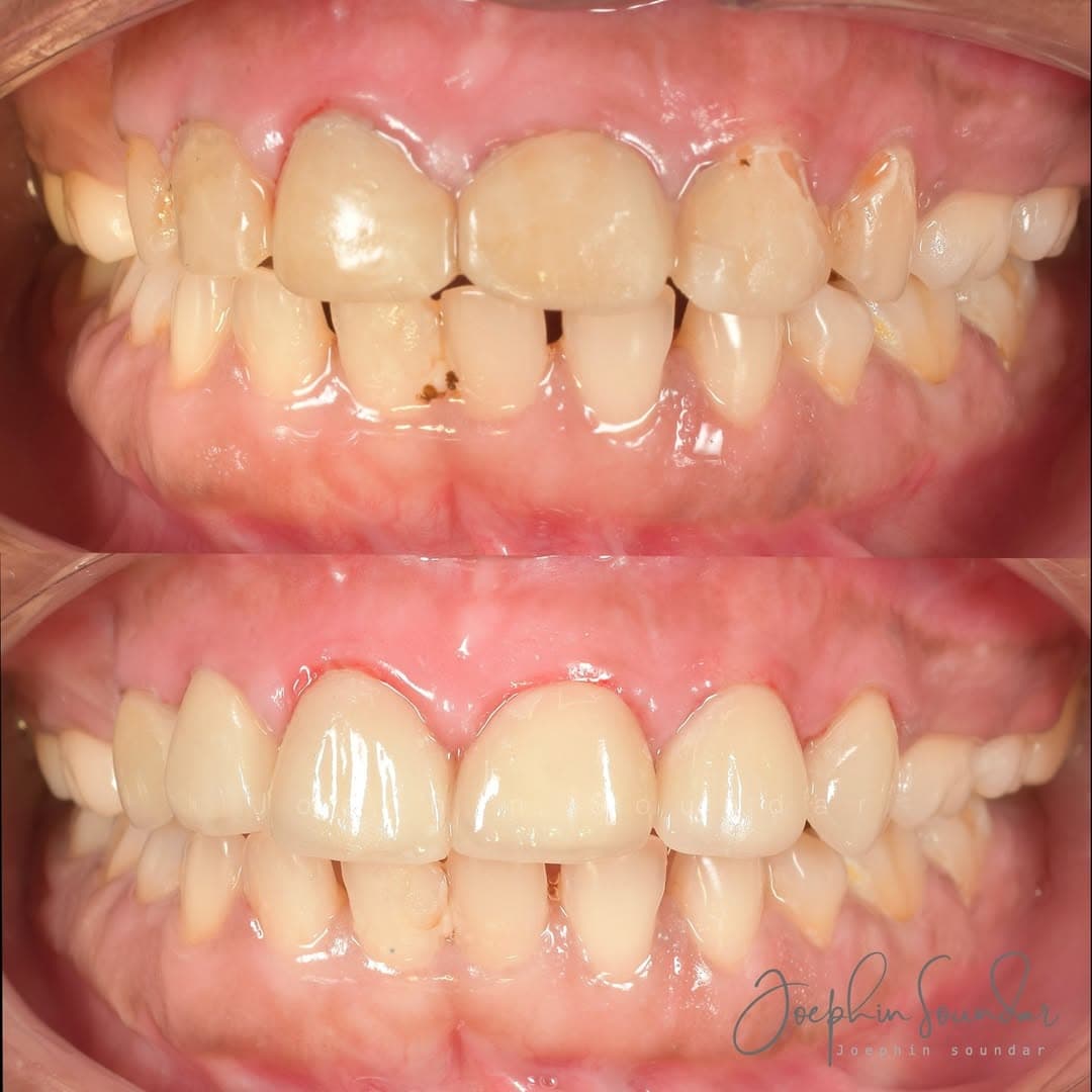 Dental Case 4