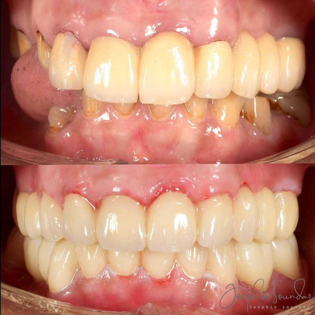 Dental Case 5