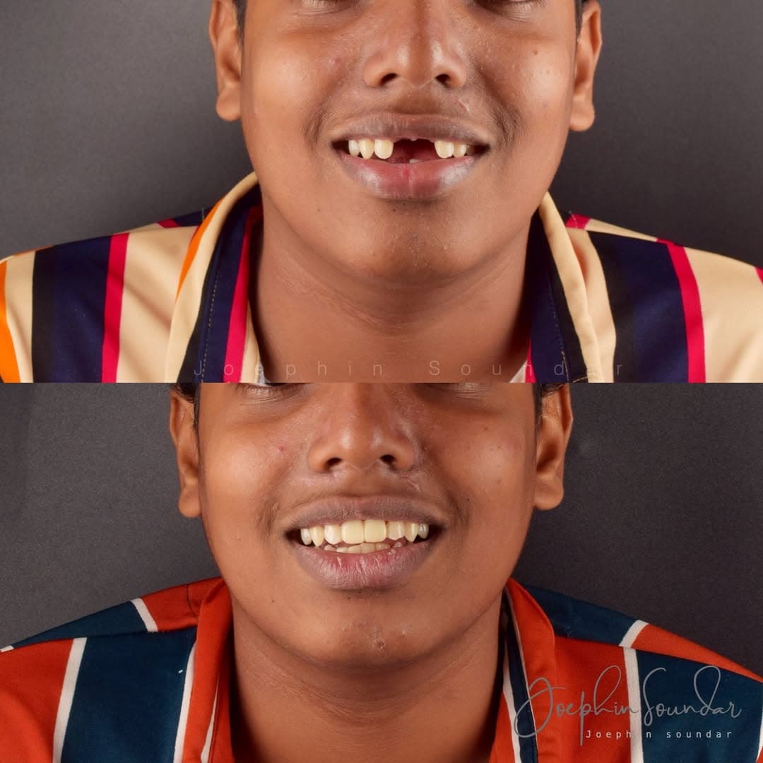 Dental Case 6