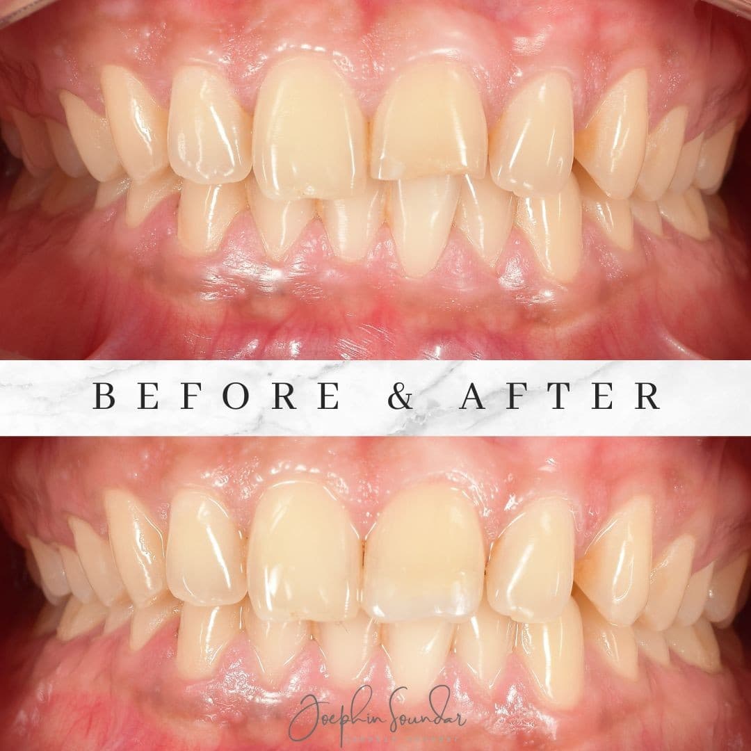 Dental Case 7