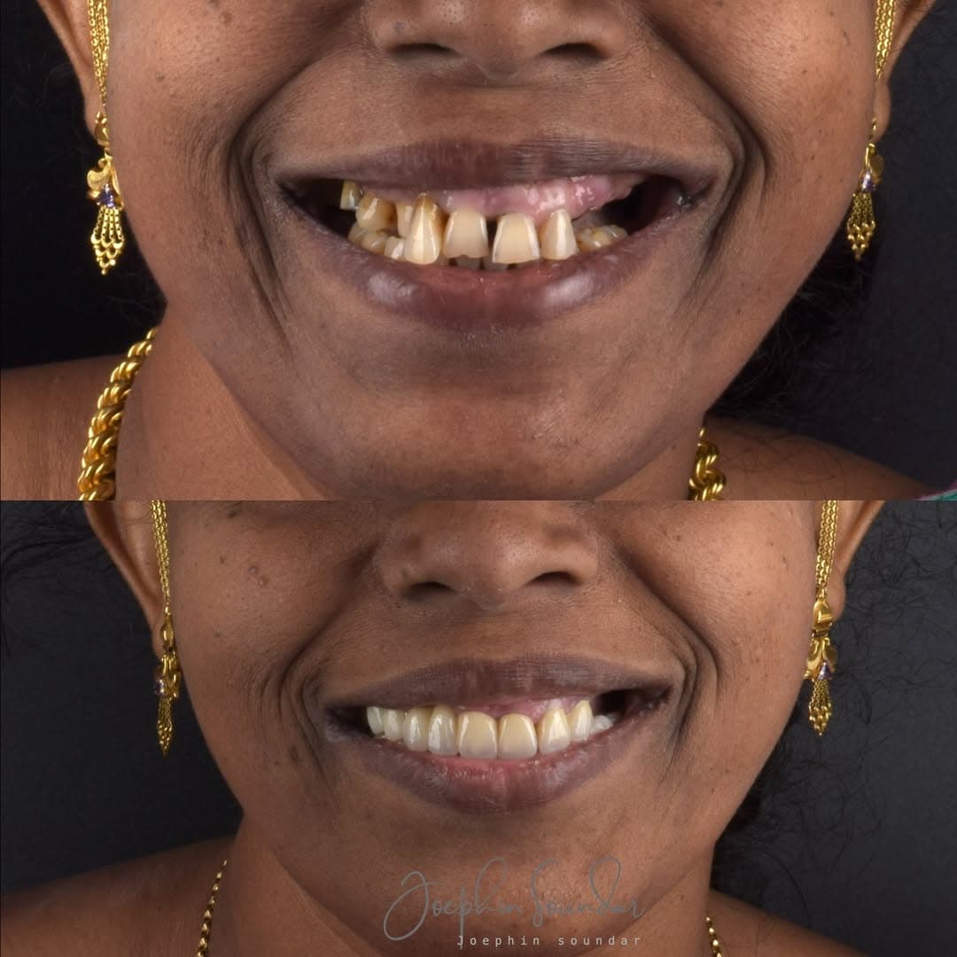 Dental Case 10