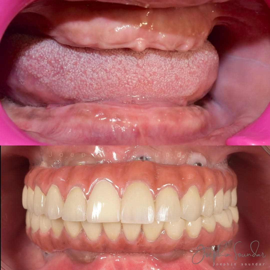 Dental Case 13