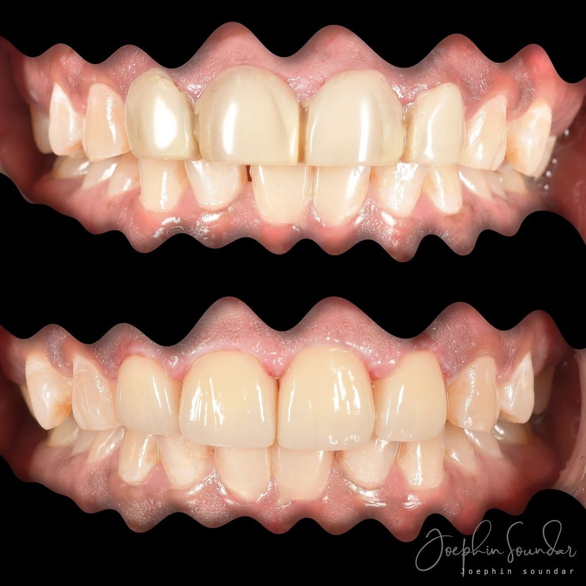 Dental Case 14