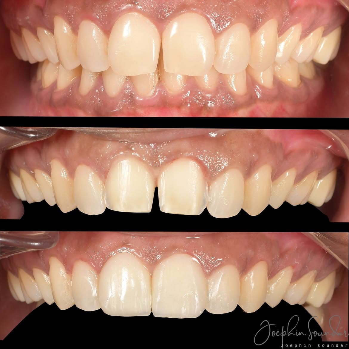 Dental Case 15