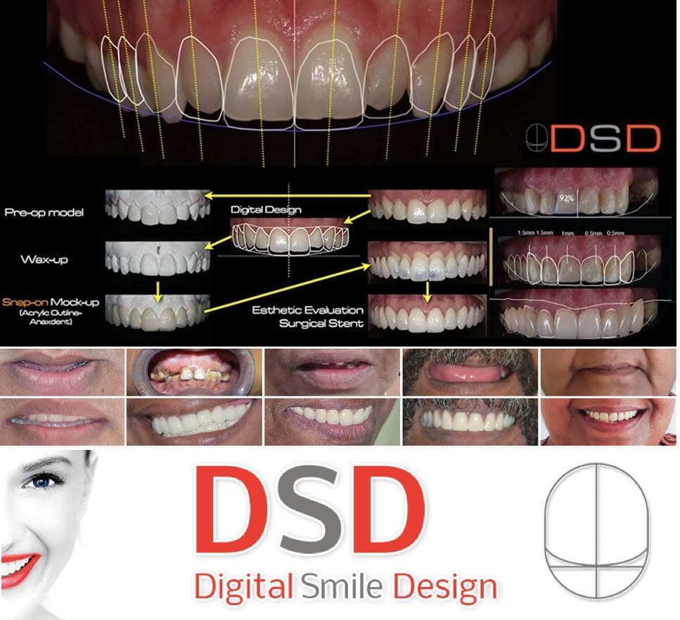 Dental Case 16