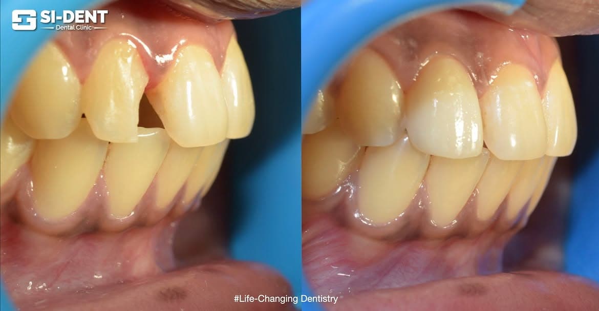 Dental Case 17