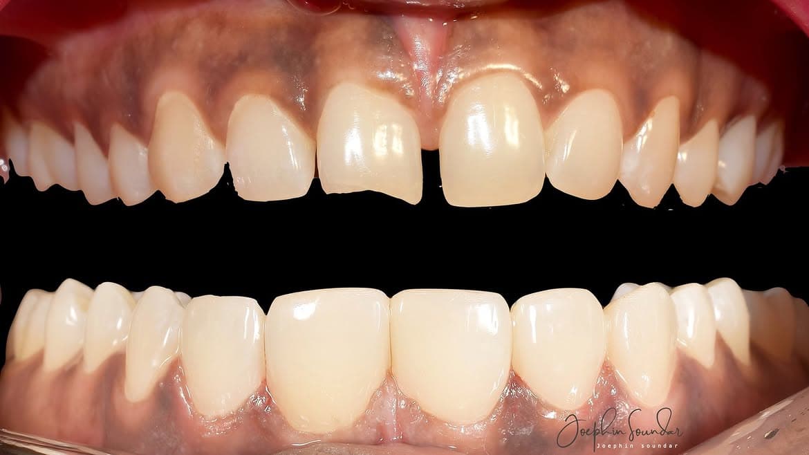 Dental Case 18