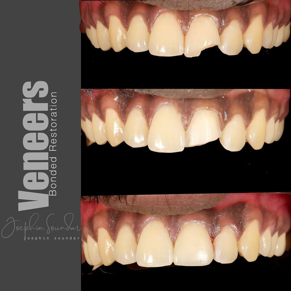 Dental Case 19