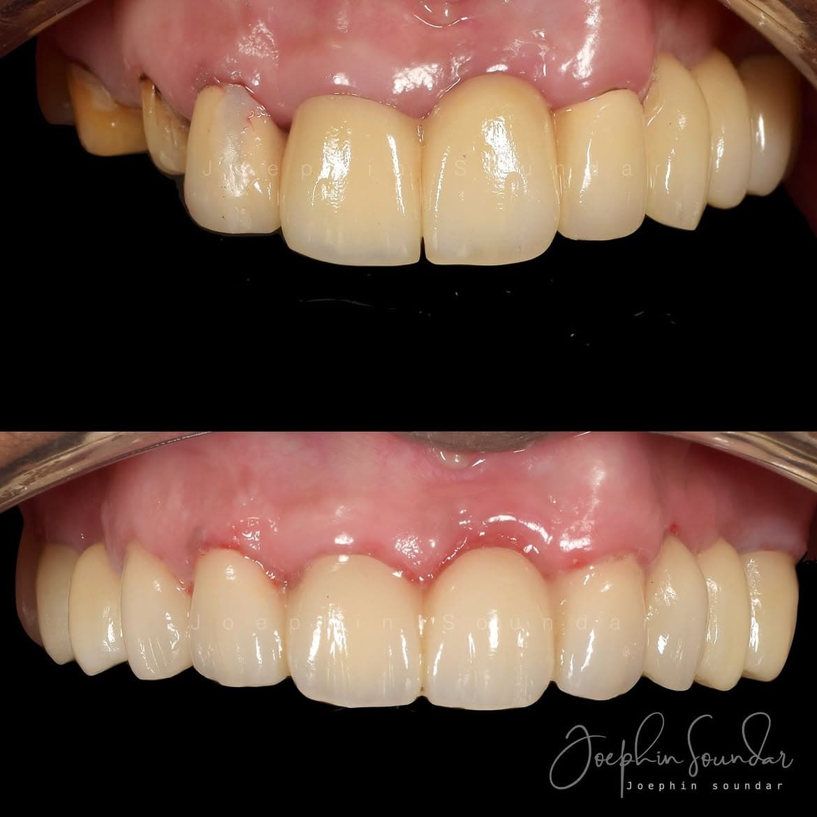 Dental Case 20