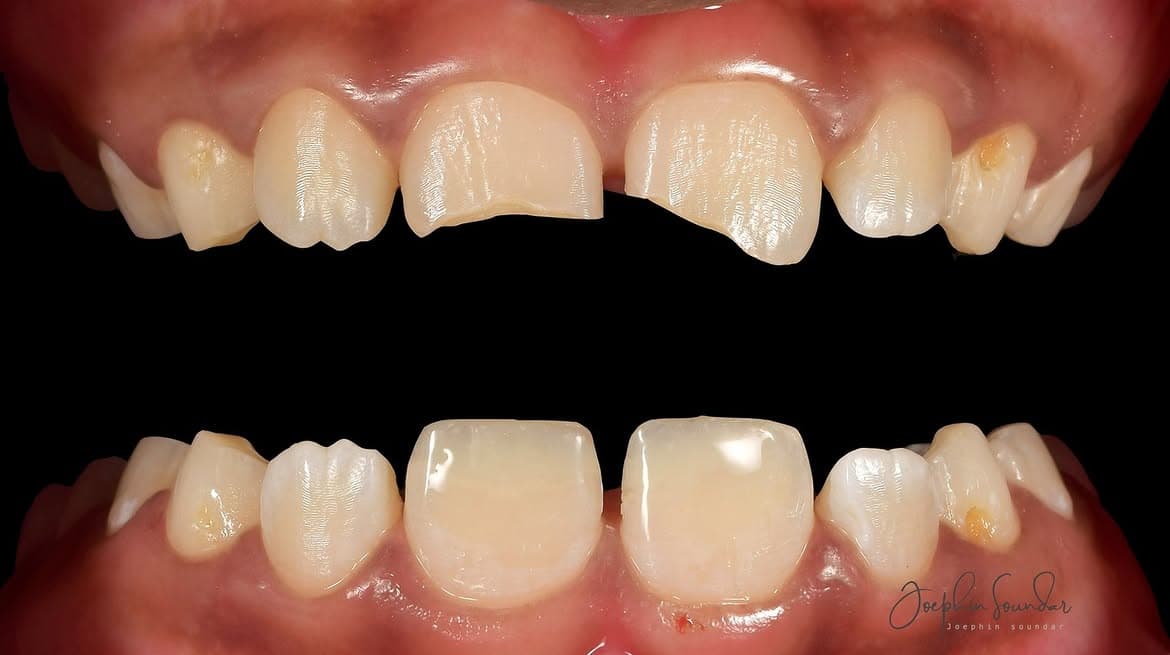 Dental Case 21