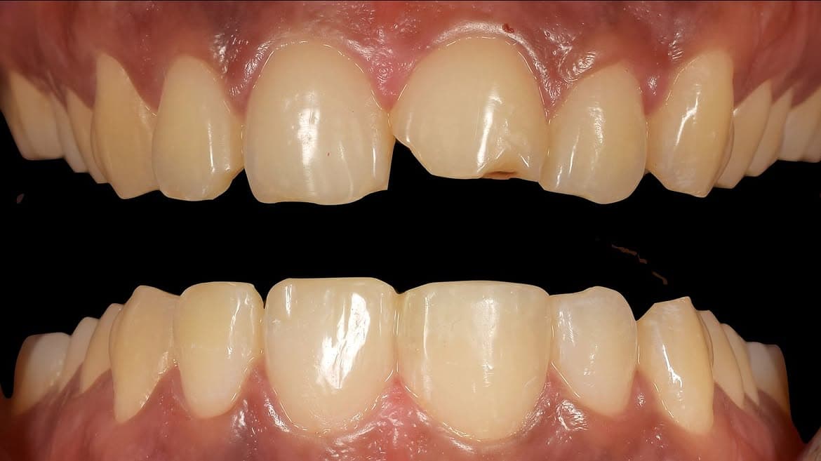 Dental Case 22
