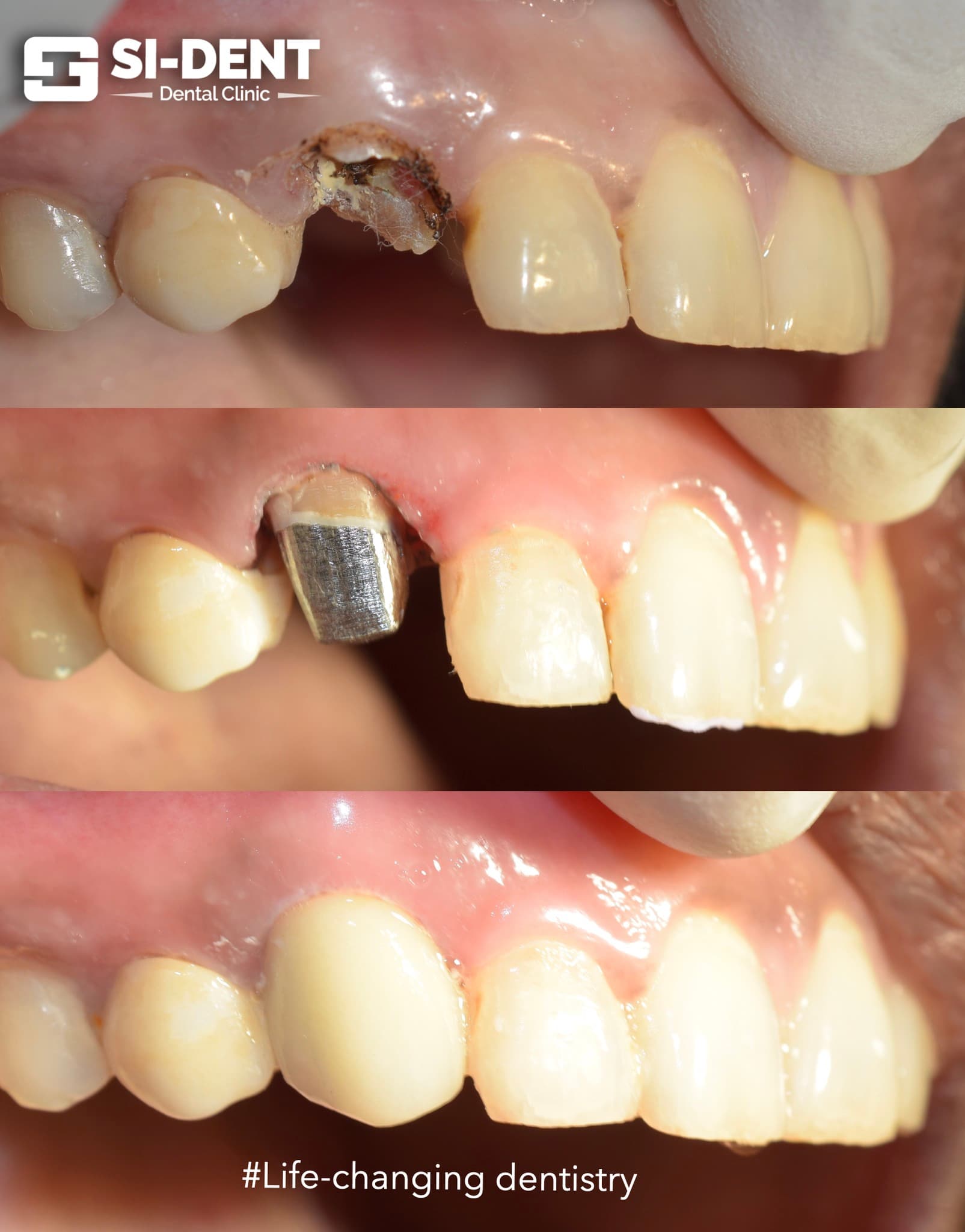 Dental Case 23