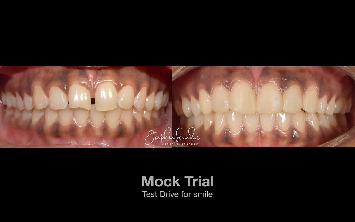 Dental Case 24