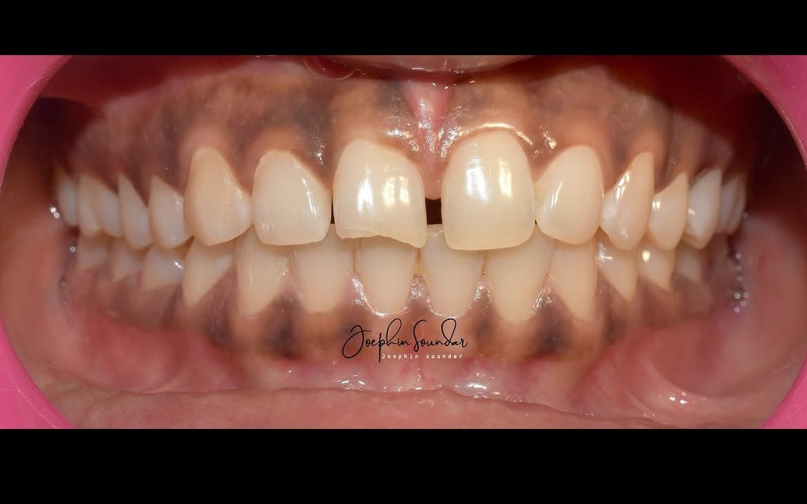 Dental Case 25