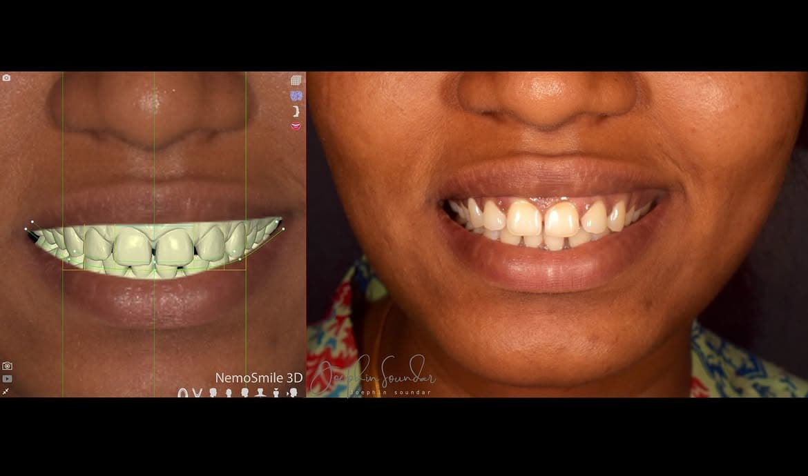 Dental Case 26