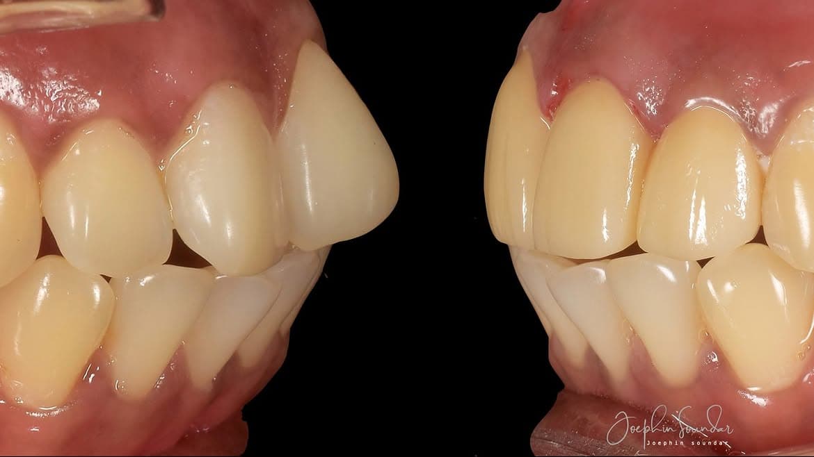 Dental Case 27