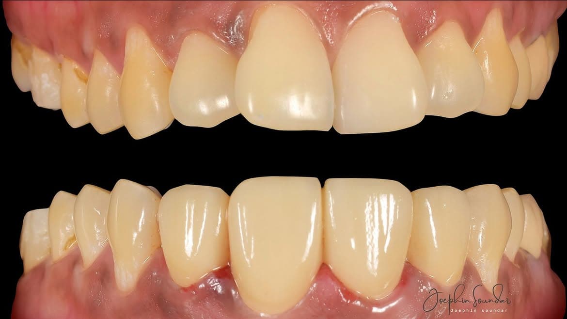 Dental Case 29