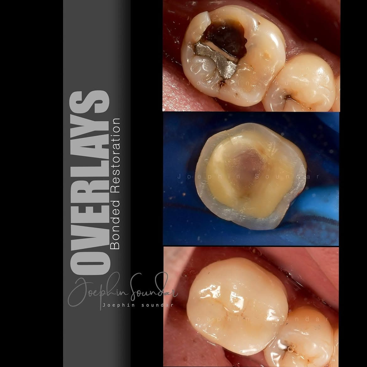 Dental Case 30