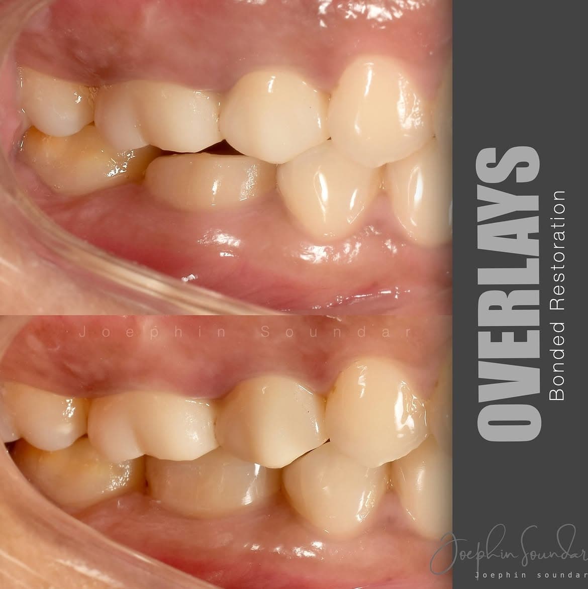 Dental Case 31