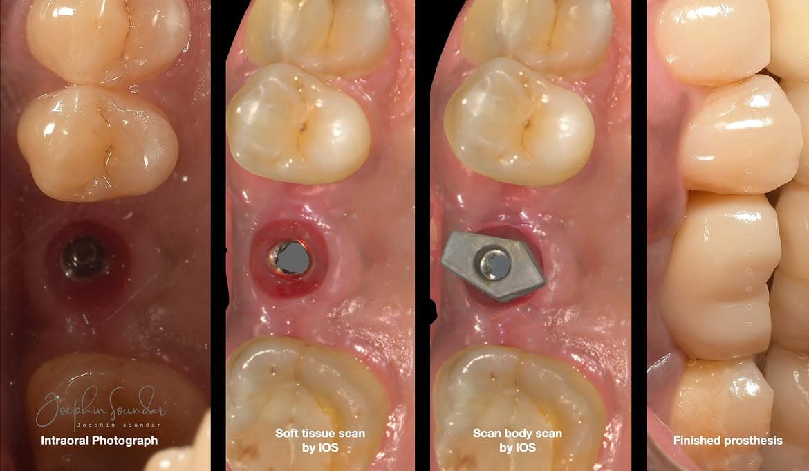 Dental Case 32