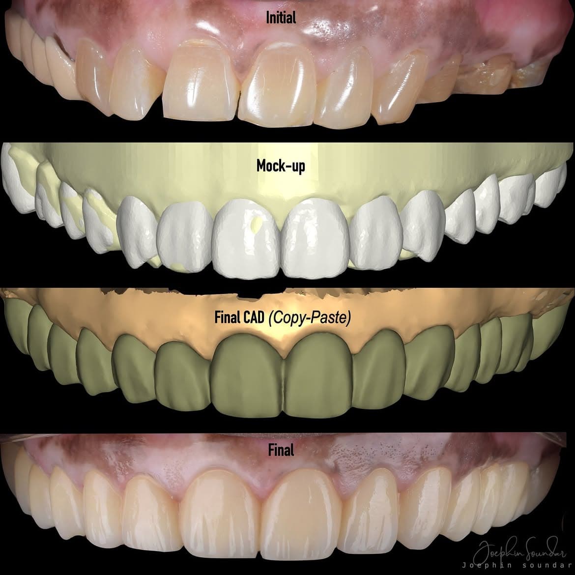 Dental Case 33