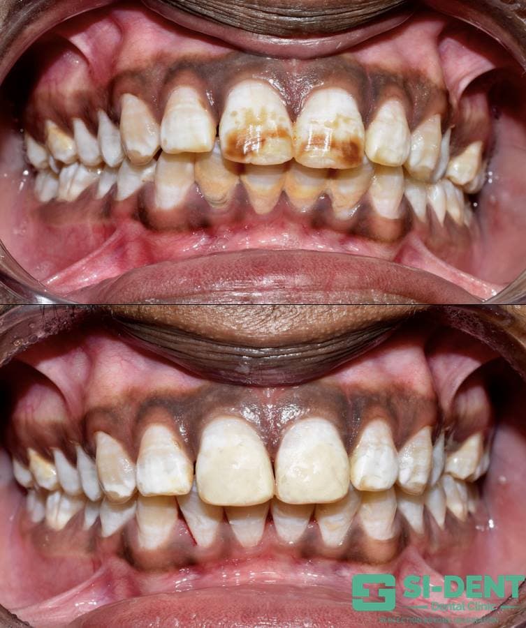 Dental Case 34