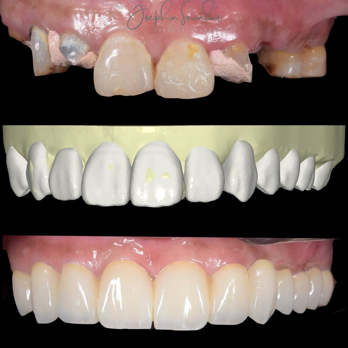Dental Case 35