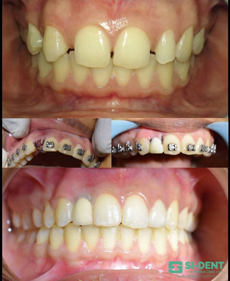 Dental Case 36