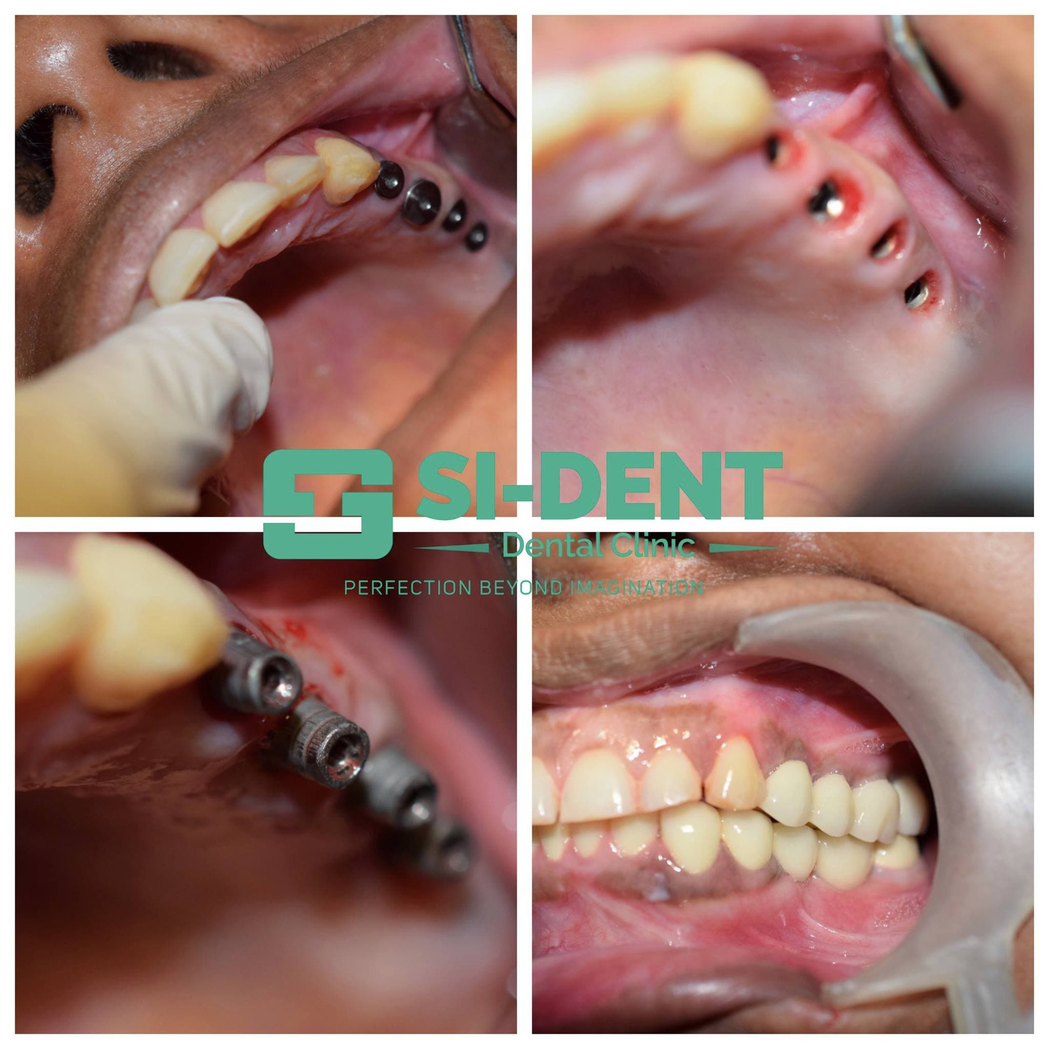 Dental Case 37