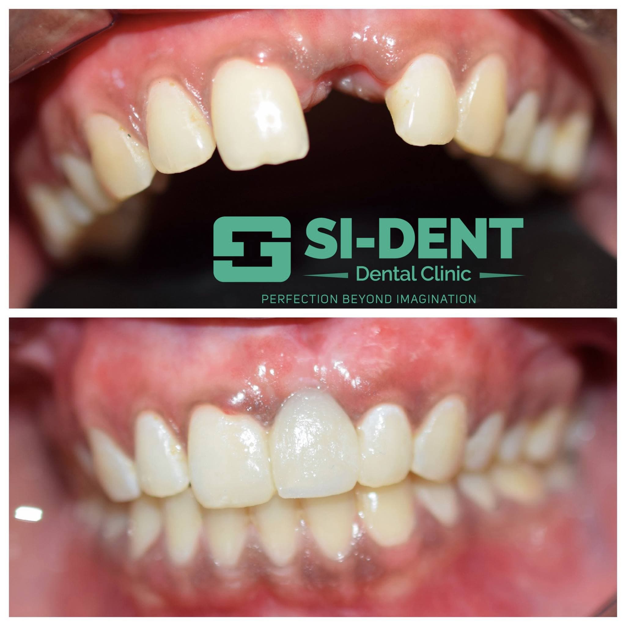 Dental Case 38