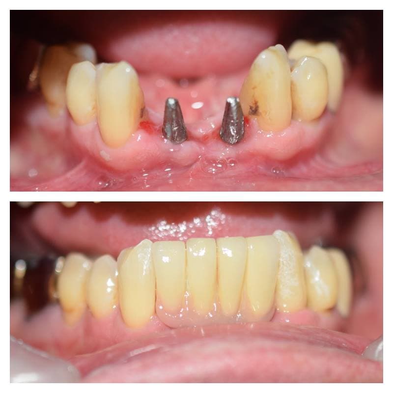 Dental Case 39
