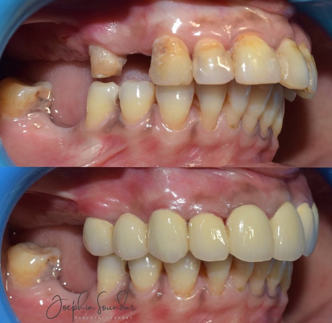Dental Case 40